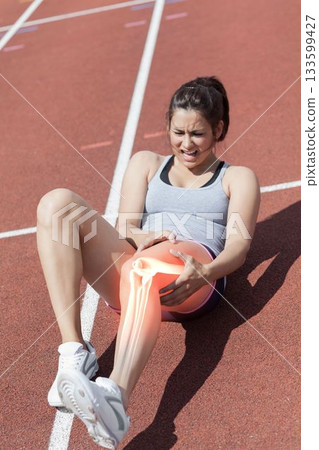 Highlighted bones of injured athlete 133599427
