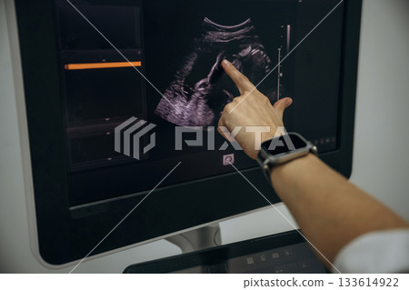 Woman is pointing the finger at display of ultrasonic device in the clinic 133614922