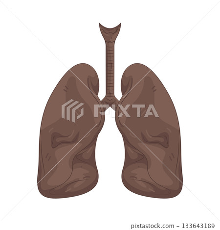 Illustration of unhealthy lungs 133643189