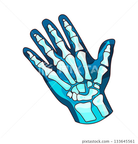 illustration of hand x-ray 133645561