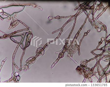 黴菌孢子囊的形成過程 黴菌孢子囊的形成過程 133651785