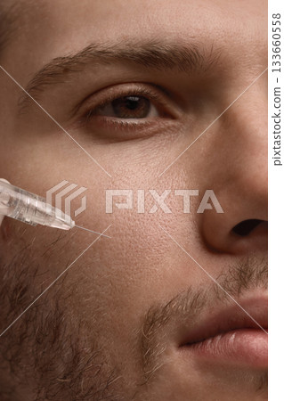 Doctor injecting dermal filler into male cheek for subtle contour refinement Doctor injecting dermal filler into male cheek for subtle contour refinement 133660558