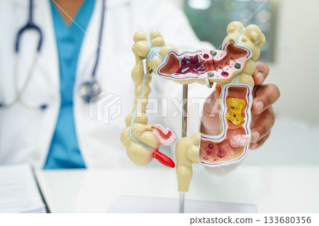 Hyperthyroidism, Overactive Thyroid, Thyroid Lymphoma, Asian woman with thyroid gland human anatomy model. Hyperthyroidism, Overactive Thyroid, Thyroid Lymphoma, Asian woman with thyroid gland human anatomy model. 133680356