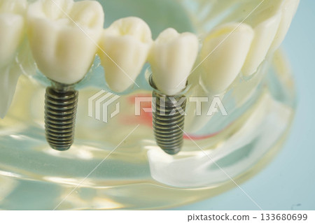 Dental teeth model on white background for learn about dentistry. 133680699