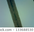 Comprehensive microscopic analysis of human hair and hair follicle characteristics 133688530