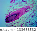 Detailed histological analysis of cross-sections of human hair follicles 133688532