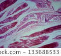 Detailed histological features of human sweat glands 133688533