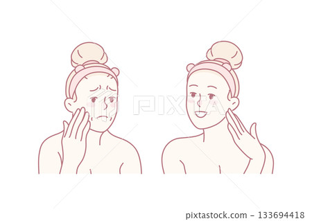 Woman before and after cosmetology procedures 133694418