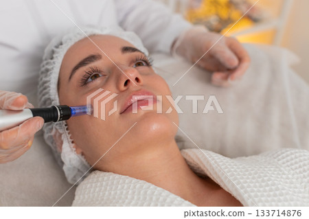 Microneedling dermapen mesotherapy for woman face regeneration by cosmetologist in beauty clinic spa 133714876