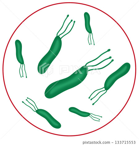 Helicobacter Pylori or H. Pylori Bacteria, Cause of Stomach Ulcers and Gastritis Helicobacter Pylori or H. Pylori Bacteria, Cause of Stomach Ulcers and Gastritis 133715553