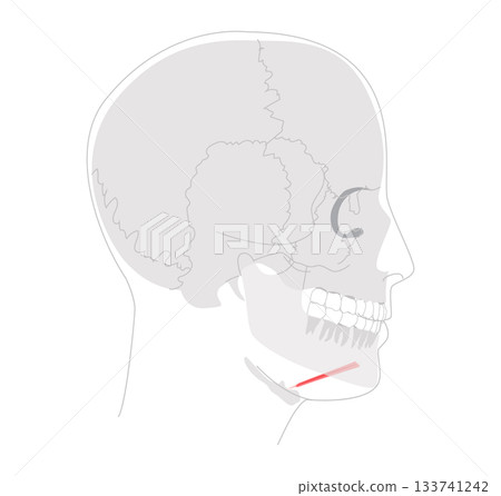 Geniohyoid - Muscle depicted in diagram connecting mandible to hyoid, functions in elevating hyoid and tongue, essential 133741242