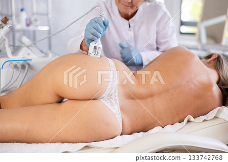 Aesthetician administering ice hammer therapy to tighten skin on female buttocks 133742768