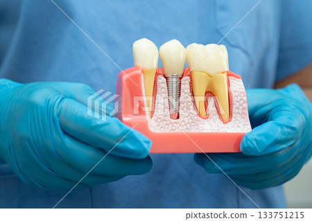 Teeth root dental model with tool for dentist use to cleaning care treatment. 133751215