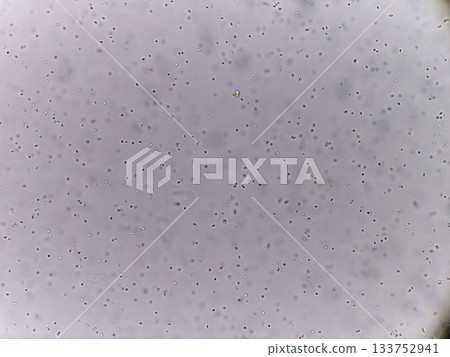 顯微鏡下觀察到的酵母菌 133752941