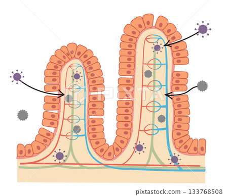 A cross-sectional illustration of small intestinal epithelial cells and an easy-to-understand illustration of leaky gut syndrome A cross-sectional illustration of small intestinal epithelial cells and an easy-to-understand illustration of leaky gut syndrome 133768508