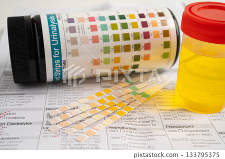 Urinalysis, urine cup with reagent strip pH paper test and comparison chart in laboratory. Urinalysis, urine cup with reagent strip pH paper test and comparison chart in laboratory. 133795375