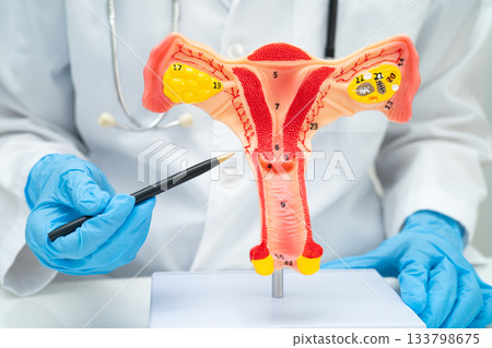Uterus, doctor holding human anatomy model for study diagnosis and treatment in hospital. Uterus, doctor holding human anatomy model for study diagnosis and treatment in hospital. 133798675