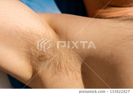 An individual showcases their underarm area with short hair visible, highlighting hair removal choices. This scene emphasizes personal grooming and summer readiness, focusing on body care An individual showcases their underarm area with short hair visible, highlighting hair removal choices. This scene emphasizes personal grooming and summer readiness, focusing on body care 133822827