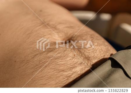 Close up view of body hair on the abdomen, highlighting various hair removal methods like waxing, shaving, and laser. Enjoying smooth skin during warmer weather Close up view of body hair on the abdomen, highlighting various hair removal methods like waxing, shaving, and laser. Enjoying smooth skin during warmer weather 133822829