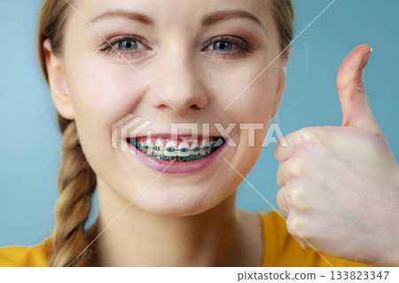 Young woman showing teeth braces 133823347