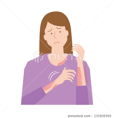 Woman suffering from itchy skin Woman suffering from itchy skin 133830393