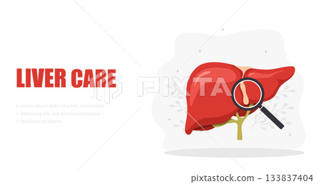Liver care concept. Internal organ diseases. Medical flat vector illustration with organ model Liver care concept. Internal organ diseases. Medical flat vector illustration with organ model 133837404