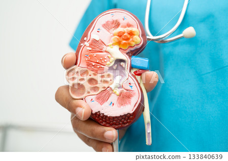 Kidney disease, Chronic kidney disease ckd, Doctor hold model to study and treat in hospital. 133840639