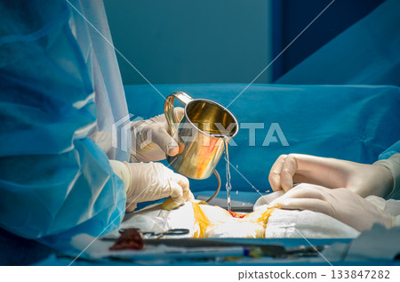 The surgeon washes the surgical field with a stainless steel mug. 133847282