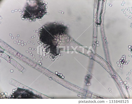 曲霉孢子的外觀 133848525