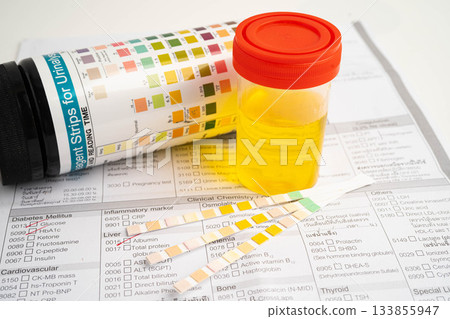 Urinalysis, urine cup with reagent strip pH paper test and comparison chart in laboratory. Urinalysis, urine cup with reagent strip pH paper test and comparison chart in laboratory. 133855947