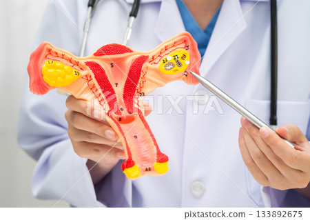 Uterus, doctor holding human anatomy model for study diagnosis and treatment in hospital. Uterus, doctor holding human anatomy model for study diagnosis and treatment in hospital. 133892675