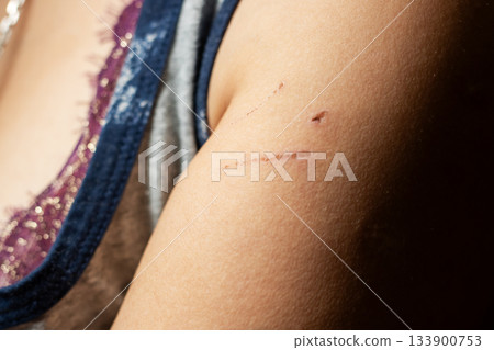 Portrait emphasizing delicate skin injuries alongside themes of strength and healing Portrait emphasizing delicate skin injuries alongside themes of strength and healing 133900753