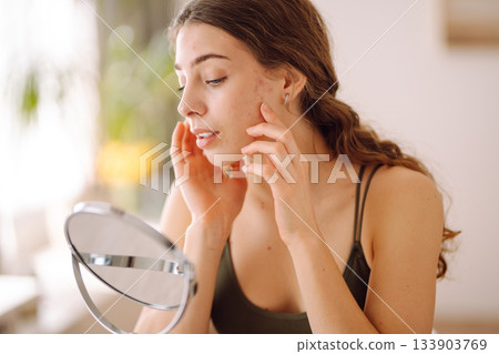 Young woman with problem skin looking into mirror. Concept of acne therapy, scars 133903769