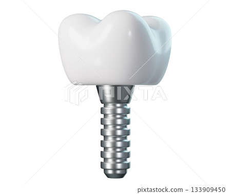 3D Dental Implant with Crown and Screw Post for Tooth Replacement. Tooth for Dental, Dentistry, Orthodontics. 3d rendering 133909450
