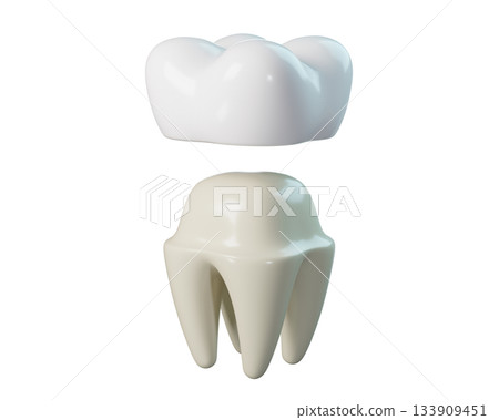 Tooth with a Detached Dental Crown. 3D Dental Implant for Dental, Dentistry, Orthodontics. 3d rendering Tooth with a Detached Dental Crown. 3D Dental Implant for Dental, Dentistry, Orthodontics. 3d rendering 133909451