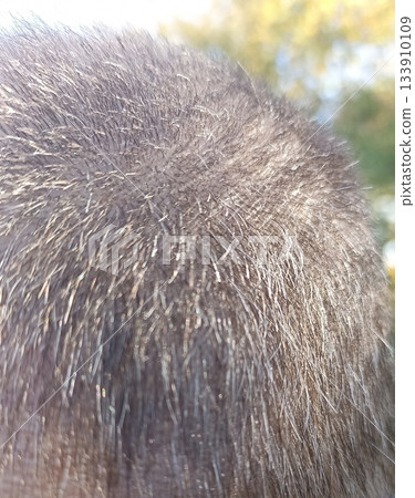 This close-up image highlights a man s scalp with thinning hair, suitable for articles on hair loss, male pattern baldness, and hair care treatments, focusing on health and beauty. This close-up image highlights a man s scalp with thinning hair, suitable for articles on hair loss, male pattern baldness, and hair care treatments, focusing on health and beauty. 133910109
