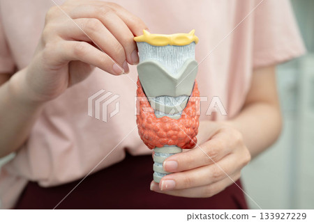 Hyperthyroidism, Overactive Thyroid, Thyroid Lymphoma, Asian woman with thyroid gland human anatomy model. Hyperthyroidism, Overactive Thyroid, Thyroid Lymphoma, Asian woman with thyroid gland human anatomy model. 133927229