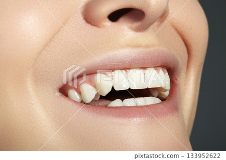 Dental Beauty. Beautiful Macro with perfect White Teeth. Fashion Lips Red Make-up. Whitening Tooth, Wellness Treatment Dental Beauty. Beautiful Macro with perfect White Teeth. Fashion Lips Red Make-up. Whitening Tooth, Wellness Treatment 133952622