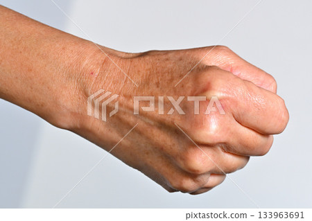 Senior's right hand: spots and wrinkles Senior's right hand: spots and wrinkles 133963691