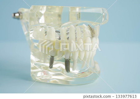 Dental teeth model on white background for learn about dentistry. 133977613