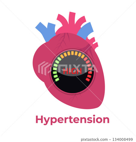 High blood pressure, hypertension concept. Vector illustration. 134008499