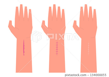 Hand cut blood, First aid treatment concept. Flat vector illustration 134008855