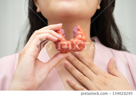 Hyperthyroidism, Overactive Thyroid, Thyroid Lymphoma, Asian woman with thyroid gland human anatomy model. Hyperthyroidism, Overactive Thyroid, Thyroid Lymphoma, Asian woman with thyroid gland human anatomy model. 134028295