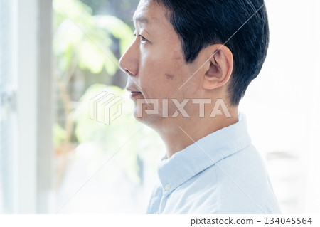 Middle-aged man with spots Middle-aged man with spots 134045564