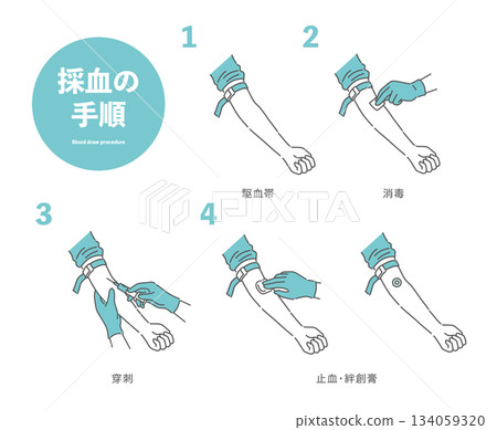 Illustration of blood collection procedure (tourniquet, disinfection, puncture, hemostasis) Illustration of blood collection procedure (tourniquet, disinfection, puncture, hemostasis) 134059320