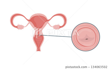 Medical illustration of the uterus and cervix 134063502