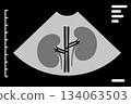 Ultrasound showing human kidneys and spine on monitor 134063503