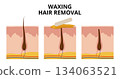 Waxing hair removal process showing before, during and after phases 134063521