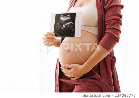 Closeup Shot Of Pregnant Lady Showing Baby Ultrasound Photo And Embracing Belly, Unrecognizable Expectant Woman Showing Sonography Shot While Standing Against Window At Home, Cropped Image 134085775