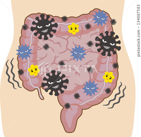 腸道環境失衡 - 人體 134087583